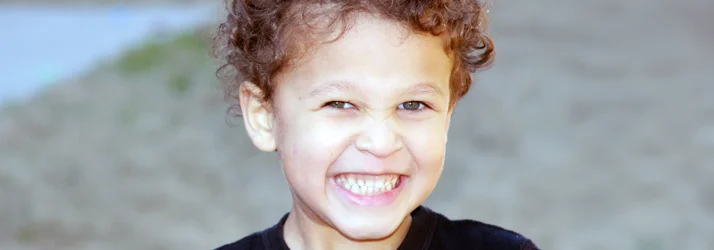 FC – Palate Expander Treatment for Growing Smiles in CITY* STATE* at CLINIC NAME*